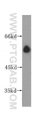 SLC45A2 Antibody in Western Blot (WB)