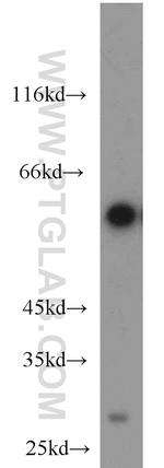 SLC45A2 Antibody in Western Blot (WB)