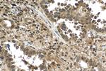 UBC Antibody in Immunohistochemistry (Paraffin) (IHC (P))