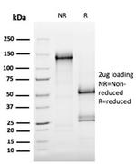 MerTK (Innate Immune Checkpoint) Antibody in SDS-PAGE (SDS-PAGE)