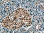 COPS4 Antibody in Immunohistochemistry (Paraffin) (IHC (P))