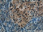 COPS4 Antibody in Immunohistochemistry (Paraffin) (IHC (P))