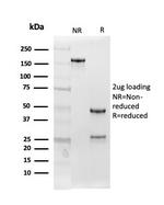 Follistatin/Activin Binding Protein Monoclonal Antibody (FST/4282)