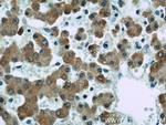 Seladin 1 Antibody in Immunohistochemistry (Paraffin) (IHC (P))