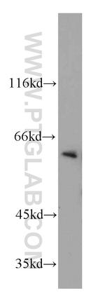 Seladin 1 Antibody in Western Blot (WB)