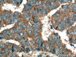 PTPN23 Antibody in Immunohistochemistry (Paraffin) (IHC (P))