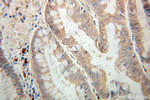 PTPN23 Antibody in Immunohistochemistry (Paraffin) (IHC (P))