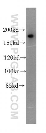 PTPN23 Antibody in Western Blot (WB)