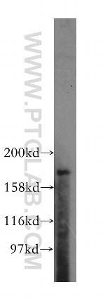 PTPN23 Antibody in Western Blot (WB)