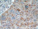 TCL1A Antibody in Immunohistochemistry (Paraffin) (IHC (P))