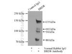 BRD8 Antibody in Immunoprecipitation (IP)