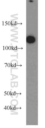BRD8 Antibody in Western Blot (WB)
