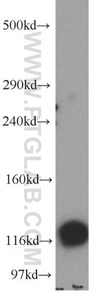 BRD8 Antibody in Western Blot (WB)