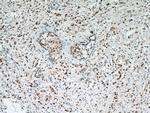 IRAK1 Antibody in Immunohistochemistry (Paraffin) (IHC (P))