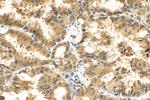 IRAK1 Antibody in Immunohistochemistry (Paraffin) (IHC (P))