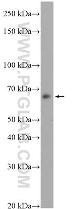 IRAK1 Antibody in Western Blot (WB)