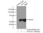 Annexin A11 Antibody in Immunoprecipitation (IP)