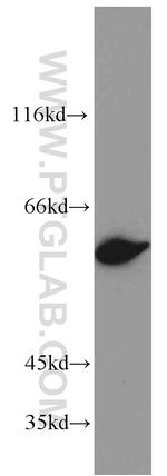 Annexin A11 Antibody in Western Blot (WB)