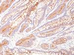 Carcinoembryonic Antigen (CEA)/CD66 Monoclonal Antibody (COL-1)
