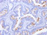 Carcinoembryonic Antigen (CEA)/CD66 Antibody in Immunohistochemistry (Paraffin) (IHC (P))