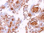 Carcinoembryonic Antigen (CEA)/CD66 Antibody in Immunohistochemistry (Paraffin) (IHC (P))