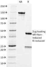 Carcinoembryonic Antigen (CEA)/CD66 Antibody in SDS-PAGE (SDS-PAGE)