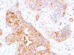 Carcinoembryonic Antigen (CEA)/CD66 Monoclonal Antibody (CEA31)