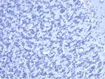 Carcinoembryonic Antigen (CEA)/CD66 Recombinant Rabbit Monoclonal Antibody (C66/6470R)