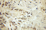 SF3B4 Antibody in Immunohistochemistry (Paraffin) (IHC (P))