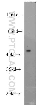 SF3B4 Antibody in Western Blot (WB)