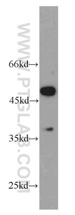 SF3B4 Antibody in Western Blot (WB)