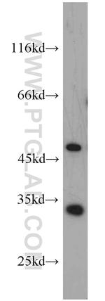 EEF1B2 Antibody in Western Blot (WB)