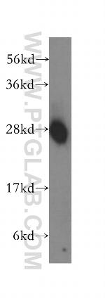 EEF1B2 Antibody in Western Blot (WB)