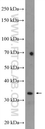 EEF1B2 Antibody in Western Blot (WB)