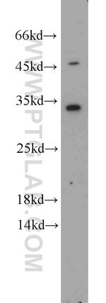 EEF1B2 Antibody in Western Blot (WB)