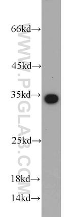 EEF1B2 Antibody in Western Blot (WB)