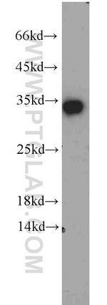 EEF1B2 Antibody in Western Blot (WB)