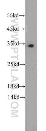 EEF1B2 Antibody in Western Blot (WB)