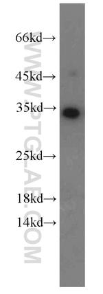 EEF1B2 Antibody in Western Blot (WB)