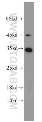 EEF1B2 Antibody in Western Blot (WB)