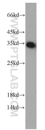 EEF1B2 Antibody in Western Blot (WB)