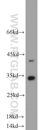 EEF1B2 Antibody in Western Blot (WB)