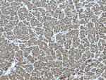 NUDT2 Antibody in Immunohistochemistry (Paraffin) (IHC (P))