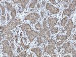 NUDT2 Antibody in Immunohistochemistry (Paraffin) (IHC (P))