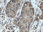 NUDT2 Antibody in Immunohistochemistry (Paraffin) (IHC (P))