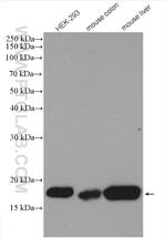 NUDT2 Antibody in Western Blot (WB)