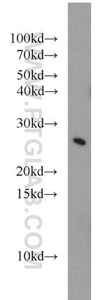 STARD5 Antibody in Western Blot (WB)