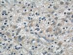 S100A14 Antibody in Immunohistochemistry (Paraffin) (IHC (P))