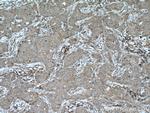 Calpain 3 Antibody in Immunohistochemistry (Paraffin) (IHC (P))