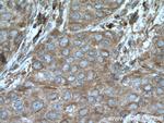 Calpain 3 Antibody in Immunohistochemistry (Paraffin) (IHC (P))